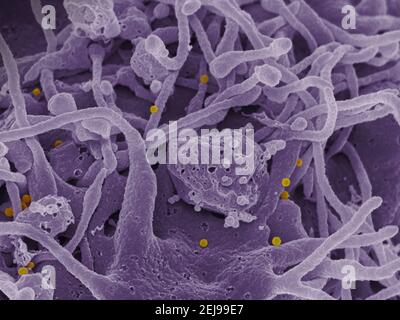 Krim-kongo hämorrhagisches Fieber (cchf)-Virus Stockfoto