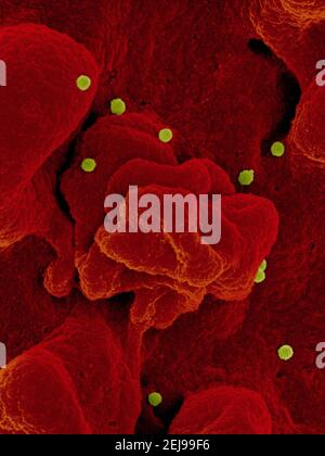 Krim-kongo hämorrhagisches Fieber (cchf)-Virus Stockfoto