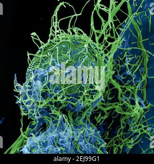 Ebola-Virus-Partikel Stockfoto