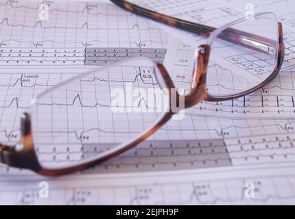 Brillen auf einem EKG in der Arztpraxis. Studium der Elektrizität des Herzens. Darstellung von Herzschlägen auf Diagrammpapier. Stockfoto