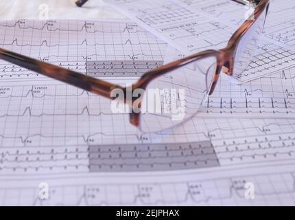 Brillen auf einem EKG in der Arztpraxis. Studium der Elektrizität des Herzens. Darstellung von Herzschlägen auf Diagrammpapier. Stockfoto