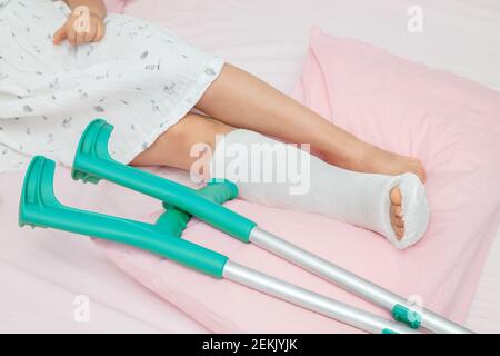 Knochenbrüche am Bein eines Kindes. Kinderbein in einem Cast auf dem Bett mit Krücken in der Nähe Stockfoto