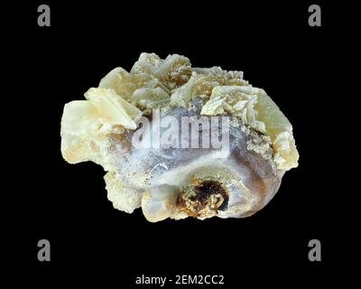 Kleiner menschlicher Nierenstein (Calciumoxalat), etwa 3mm in der Länge, unter dem Mikroskop Stockfoto