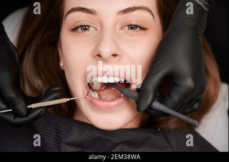 Nahaufnahme des Zahnarztes Untersuchung junge Frau Zähne mit Zahnspiegel und Forscher. Patient mit offenem Mund mit prophylaktischen Untersuchung in der Zahnklinik. Konzept der Zahnmedizin und Zahnpflege. Stockfoto