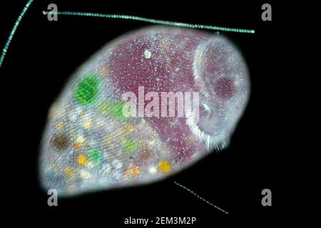 Trompete-Animalcule (Stentor spec.), Differential Interference Contrast image, Vergrößerung x40 bezogen auf 35 mm, Deutschland Stockfoto