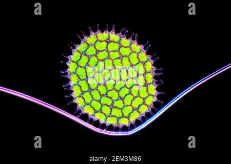 Grünalge (Pediastrum spec.), koloniebildende Grünalgen, Dunkelfeld mikroskopisches Bild, Vergrößerung x100 bezogen auf 35 mm Stockfoto