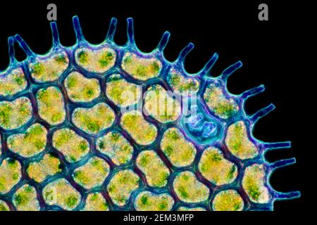 Grünalge (Pediastrum spec.), koloniebildende Grünalgen, Dunkelfeld mikroskopisches Bild, Vergrößerung x180 bezogen auf 35 mm Stockfoto