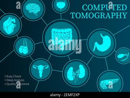 Computertomographie, Medizin, Vektor-MRT-Diagnostik und CT-Scan der inneren Organe, diagnostische Medizin. Magnetresonanztomographie der Nieren, blad Stock Vektor