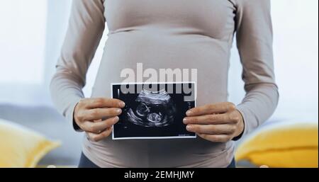 Beschnittene Ansicht der schwangeren Frau, die Ultraschalluntersuchung des Babys zeigt Stockfoto