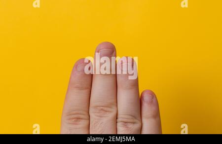 Nahaufnahme männliche Finger mit gebissen, gebissen, gekaut oder hässlichen Nägeln, ein bisschen schlechten Nagel und isoliert auf einem gelben Hintergrund Stockfoto