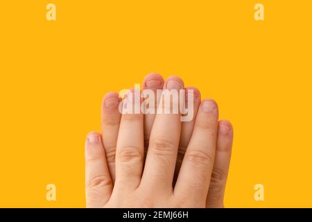 Nahaufnahme männliche Finger mit gebissen, gebissen, gekaut oder hässlichen Nägeln, ein bisschen schlechten Nagel und isoliert auf einem gelben Hintergrund Stockfoto