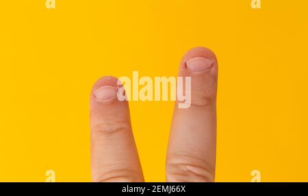 Nahaufnahme Male zwei Finger mit gebissen, gefwaned, gekaut oder hässlichen Nägeln, ein bisschen schlechten Nagel und isoliert auf einem gelben Hintergrund Stockfoto