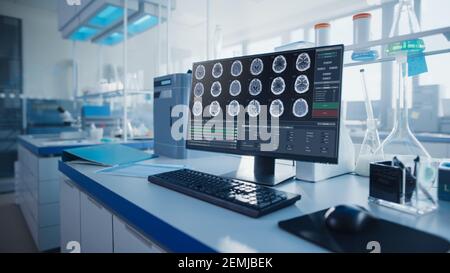 Modernes medizinisches Forschungslabor mit Computer, der MRT-Gehirnscans zeigt. Glaswaren mit Biochemikalien auf dem Schreibtisch. Wissenschaftliche Labortechnologie Stockfoto