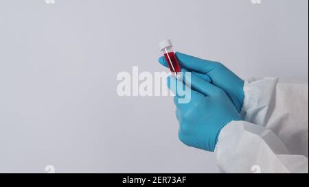 Blutschlauch. Covid 19 Test. Arzt Hand hält ein Blutprobenröhrchen für die Analyse im Labor Hintergrund. Techniker in medizinischen Handschuhen, die den Blutschlauch halten Stockfoto