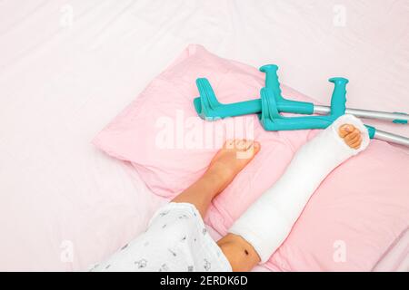 Knochenbrüche am Bein eines Kindes. Kinderbein in einem Cast auf dem Bett mit Krücken in der Nähe.Draufsicht Stockfoto