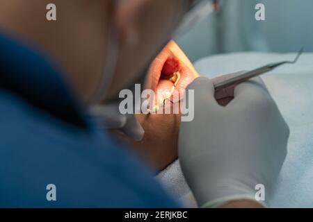 Kieferorthopäde mit dentalen Scaler während der Überprüfung für den Kunden Stockfoto
