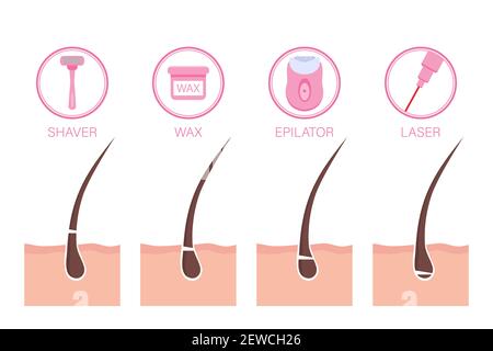 Verschiedene Methoden der Haarentfernung und Epilation. Vektorgrafik im flachen Stil mit Platz für die Gestaltung Stock Vektor