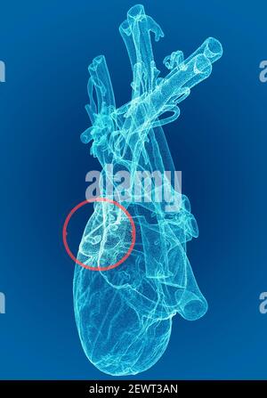 Herz, Ventrikel, menschliche Anatomie, Herzventrikel. Menschlicher Körper, Abschnitt. Röntgenansicht. HUD. Fortschrittliche Wissenschaftliche Geräte. Hologramm. Scanner. 3D Rendern Stockfoto