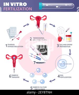 Farbige flache in-vitro-Fertilisation IVF-Infografiken mit Schritten von Ovarielle Überstimulation zur Schwangerschaft Vektordarstellung Stock Vektor