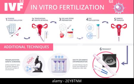 Farbige in-vitro-Fertilisation IVF flache Infografiken mit Schritten von Zusätzliche Techniken Vektordarstellung Stock Vektor