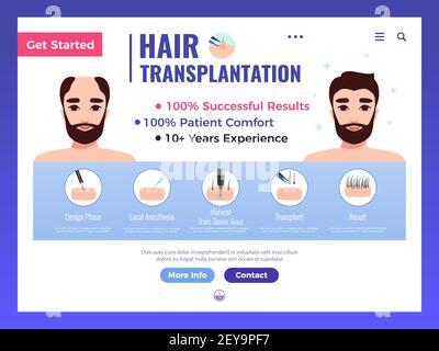 Webbanner für Haartransplantation mit Infografiken-Werbung und Interface-Elementen Vektorgrafik auf weißem Hintergrund Stock Vektor