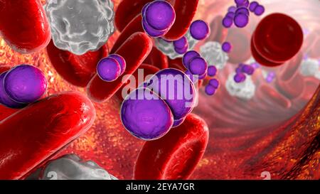 Meningokokzämie, Illustration Stockfoto