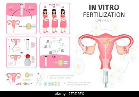 Flaches in-vitro-Fertilisation Infografik Konzept mit schwangeren Frauen Sperma Vorbereitung befruchtete Eizelle Entwicklung medizinische Werkzeuge für künstliche insemina Stock Vektor