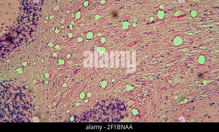 Bilder von biologischen Zellen unter dem Mikroskop Stockfoto