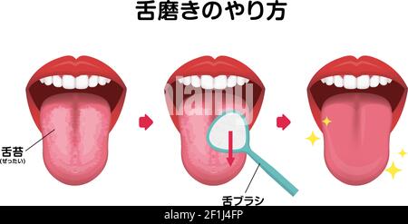 Wie Sie Ihre Zunge Vektorgrafik reinigen (Mundgeruch Prävention) Stock Vektor