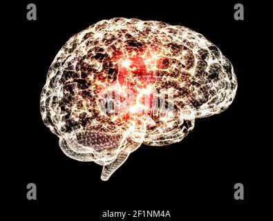 Schmerzen im Kopf, Gehirn und Synapsen, kognitive Probleme, geistige Defizite. Aneurysma. Degenerative Erkrankungen des Hirnareals. Parkinson, Schlaganfall Stockfoto