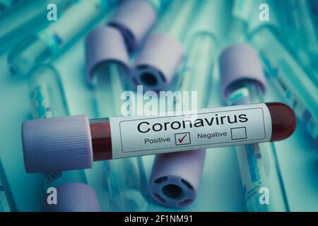 Izmir, Türkei - April 15 2020: Blutproben auf Vorhandensein von Coronavirus (COVID-19)-Röhrchen mit einer Blutprobe, die positiv auf c getestet wurde Stockfoto