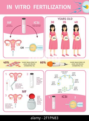 In-vitro-Fertilisation infographic Konzept mit Prozessen und Verfahren der Künstliche Befruchtung und Chancen der Schwangerschaft in verschiedenen Altersgruppen Vektor Stock Vektor