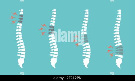 Rückenschmerzen Dornen eingestellt. Vektor Rückenschmerzen Symbol Illustration isoliert. Beschädigte Festplatten Stock Vektor