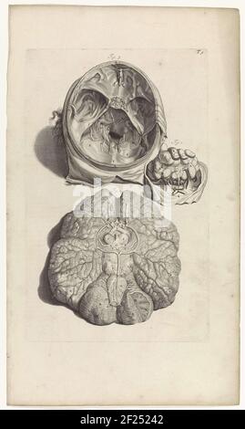 Zwei Vorstellungen. Oben: Anatomische Untersuchung der Schädelinnenseite. Unter: Anatomische Studie des Gehirns. Oben rechts nummeriert T. 9. Stockfoto