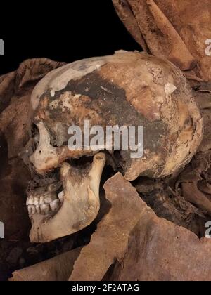 Menschlicher Schädel des sechzehnten Jahrhunderts. Foto aufgenommen auf dem Fontanelle Friedhof in Neapel Stockfoto