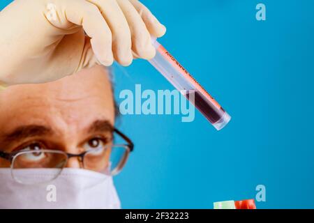 Laborant hält eine Hand mit der Blutprobe Stockfoto