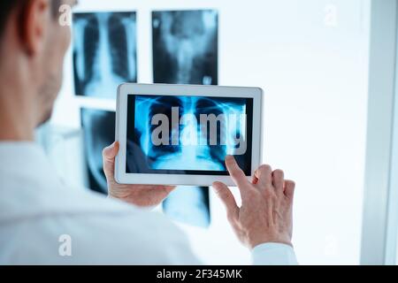 Arzt untersucht Röntgenaufnahme der Brust und Rippen auf digitalen Tablette. Stockfoto
