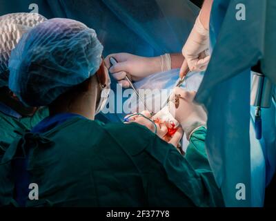 Der Chirurg hält den elektrischen Koagulator während der proktologischen Operation am Anus. Nahaufnahme - Hände mit Blut in sterilen Handschuhen bedeckt. Blau Stockfoto