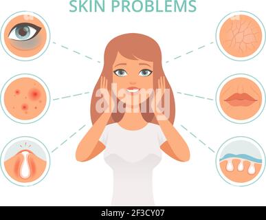 Hautprobleme. Schönheit Frau Peeling Pflege Gesicht Infektion Dunkelheit Peelings ölige Gesicht reinigen Vektor-Symbole Stock Vektor