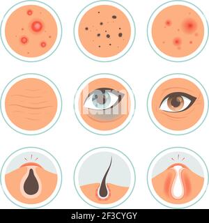 Hautprobleme. Dunkle Kreise Frau Infektion vor Ort waschen Haut ölige Gesicht Alter Pore reinigen Vektor medizinische Symbol Stock Vektor