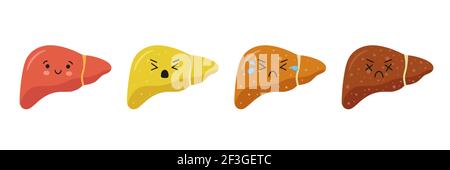 Stadien der nichtalkoholischen Leberschäden. Gesund, fettig und Zirrhose. Lebererkrankung. Stock Vektor