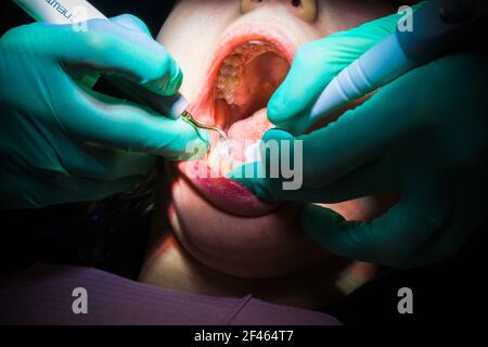 Europäische Patientin auf Zahnarztbesuch während des zahnärztlichen Eingriffs. Stockfoto