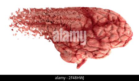 Gedächtnis verfällt, Dinge vergessen, degenerative Krankheit. Gehirnprobleme. Parkinson und alzheimer Krankheit. Psychische Gesundheit. Schlaganfall, Synapsen und Neuronen Stockfoto