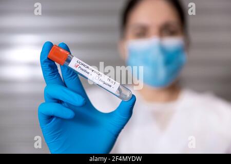 Nahaufnahme eines medizinischen Mitarbeiters, der ein Reagenzglas mit einer positiven Probe des Covid-19-Virus zeigt. Selektiver Fokus, Platz für Text. Stockfoto