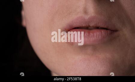 Herpes auf den Lippen, eine Frau mit einer Wunde auf der Lippe Nahaufnahme Stockfoto