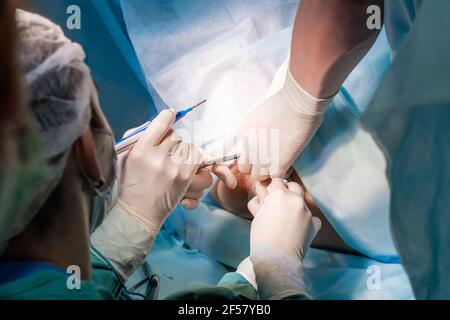 Der Chirurg hält den elektrischen Koagulator während der proktologischen Operation am Anus. Nahaufnahme - Hände mit Blut in sterilen Handschuhen bedeckt. Minimal Stockfoto