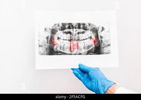 Arzthand in schützendem medizinischen Handschuh halten und untersuchen ein Röntgenbild der Zähne auf weißem Hintergrund. Stockfoto