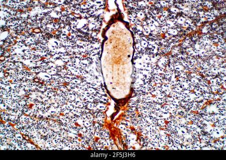 Rückenmark, leichter Mikrograph Stockfoto