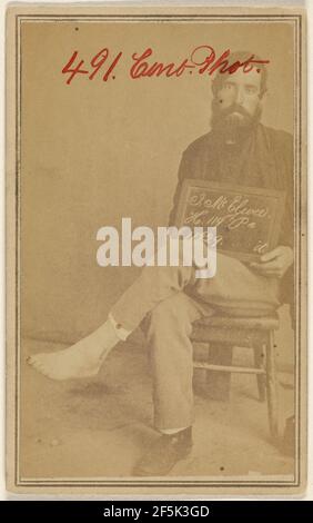 J. McElwee, H. 119th Pa. Bürgerkriegsopfer. Unbekannter Hersteller, Amerikaner Stockfoto