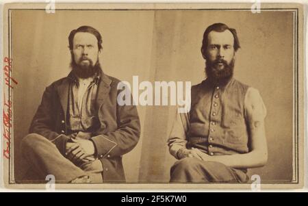 Zwei nicht identifizierte Opfer des Bürgerkriegs sitzen. Zugeschrieben William H. Bell (Amerikaner, 1830 - 1910) Stockfoto